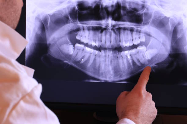 Best Knocked-Out Tooth Emergency  in Leonard, TX