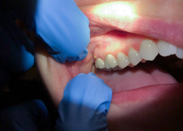 Best Root Canal Emergency Dentist  in Leonard, TX